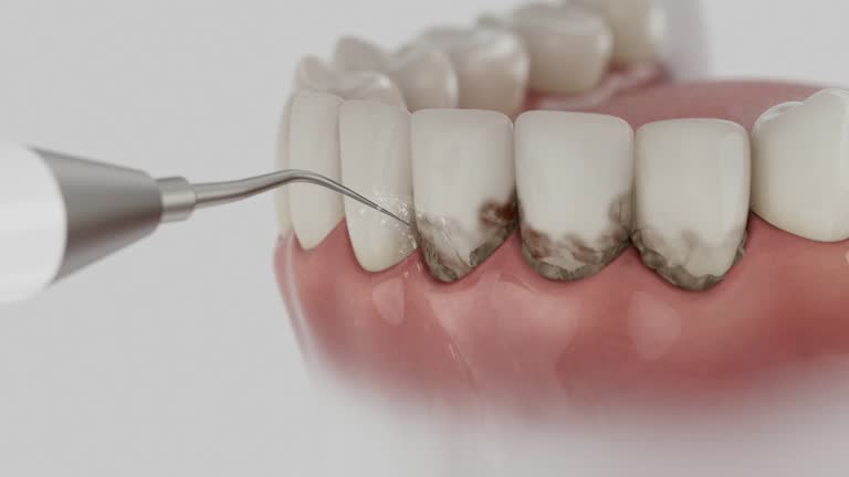 Reliable Dental Implants contractor in Stanley, ND by Smile Center Dentistry